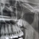 쏙쏙사랑니치과의원 이미지