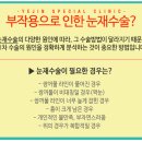 예진성형 네이버블로그