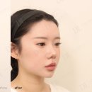 윤곽