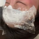 눈썹공룡 | 신논현역피부과 이마필러 잘하는곳 자연스운 필러 후기