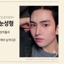 첫눈성형외과의원 네이버블로그