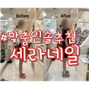뉴세라 | 인천 맞춤인솔 잘하는 곳 세라네일｜간석동 발교정 자세교정 내돈내산 솔직후기
