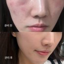 본메디케어 | 사직동피부샵 1:1 맞춤관리라 더 만족했던 동래에스테틱 스웰드 내돈내산 후기