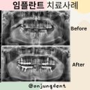 온정치과의원 이미지