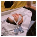 소광 | 홍대 리프팅 통증없이 중안부 축소하는 엠페이스 효과 후기