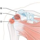 왼쪽 어깨 통증 원인 및 치료 이미지