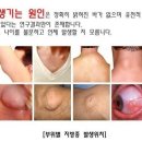 제이에스(JS)항외과의원 네이버블로그