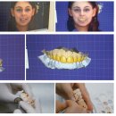 미라클치과기공소 이미지