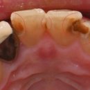 의정부본플란트치과의원 이미지