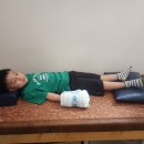 바른윤오정형외과의원 | 아들 손가락 인대손상 치료기록...