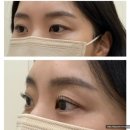 연메디 | 분당 미금역속눈썹펌 #채비연래쉬 #시그니쳐클래식펌 #주차 만족후기
