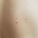 365봄날약국 | [병원정보/대상포진] **365 vs 오라클피부과