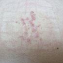 매일열린약국 | 더마틱스 울트라 겔 효과 후기 화상 흉터 연고 내돈내산 솔직 후기