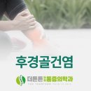 더튼튼마취통증의학과의원 | 후경골건염, 평발을 유발하는 발 안쪽의 통증