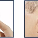 에바다보청기 이미지