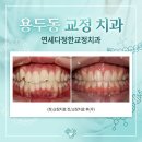 아름다운치과의원 | 용두동 교정 치과 선택 시 피해야 할 3가지