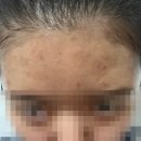 꽃 피우는 여자 | 대구 진천동 문제성피부관리 '꽃피우는여자' 재재재재방문 솔직후기