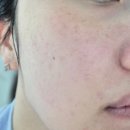 연세코스메틱 | 화잘먹 미스트 추천 | 자연산 엑소좀 미스트 후기 (킨텍스 코스메틱 전시회 발견템)