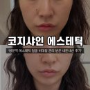 쌍문코지샤인에스테틱 | [도봉] 쌍문역 에스테틱 '코지샤인 에스테틱' 얼굴 비대칭 케어 내돈내산 후기