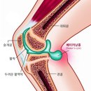 슬와낭종 이미지