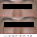 벌크커피하남메가박스점 | 하남 미사피부과 : 3월 헬로 스프링! 봄봄 이벤트 - 스킨리바이브 온다 울쎄라 올리지오 리투오 쥬베룩...