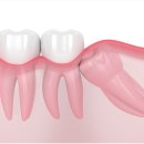 단단플란트치과의원 이미지