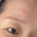 루미나 | 송파 에스테틱 / 루미나에스테틱 물광, 탄력 피부관리 후기