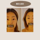 하남 미사역 에스테틱 피부관리 동안스테이 윤곽관리 후기