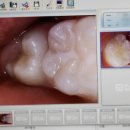 참편한치과의원 이미지