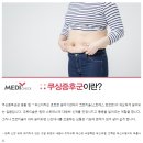 배만 볼록? 쿠싱증후군 증상과 원인 이미지