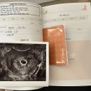 상주제일병원 | 동탄 산부인과 고민이라면?｜위대한탄생 vs 동탄제일병원 비교 후기