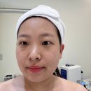 제이아쿠아짐 | 시흥 은행동 피부관리 제이렐라에스테틱 아쿠아필 LDM 수분관리 찐후기