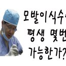 모발이식후 일상생활 (모발이식,머리심기,모발이식비용) 이미지