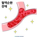 손이 붓는 이유 알아보기 이미지