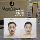 퀸즈시크릿 | 대구경락 비대칭 솔직후기 (퀸즈시크릿)