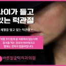 바른얼굴덕치과의원 이미지