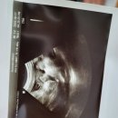두란노문구 | 신생아검사,제대혈,RSV,송파고은빛 입원), 3)진통주기어플 추천 ☕️4)잠실새내 새마을시장 두란노커피 추천!