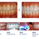 미소필치과의원 이미지