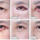 비씨아이성형외과의원 이미지