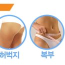 예미안박권식의원성형외과