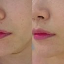 명지에스테틱 추천 물오름에스테틱 수분듬뿍 맞춤형관리 후기