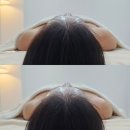 GS25경산백천점 | 경산피부관리 물오른피부 경산점 윤곽밸런스 비대칭 개선 찐후기