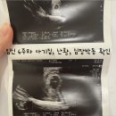 박동 | 임신 6주차 아기집 난황 심장박동 깜빡임 5일동결 배아이식 24일차 초음파