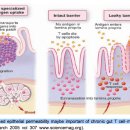 Re:장누수 증후군(leaky gut syndrome) - 장관투과성 증가로 세균, 독소, 항체 유입되는 상태 이미지