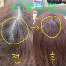 볼륨15구미점 | 📢 구미미용실추천✨ 뿌리 볼륨 살리는 링거펌 받고 대변신! 러블랑헤어 솔직 후기 💕