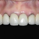 치아사랑치과기공소 이미지