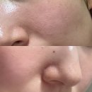 뽕뽕이약국 | 닥터비타 모공크림 전후비교 찐후기