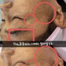 The,꼼꼼skin