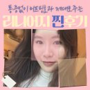 용산-400 | 신용산피부과 리니어지리프팅 400샷 리얼후기