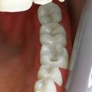 윤치과기공소 이미지